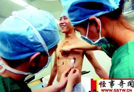在广州某整形美容医院完成了丰胸手术,迈出了从男性变为女人的第一步